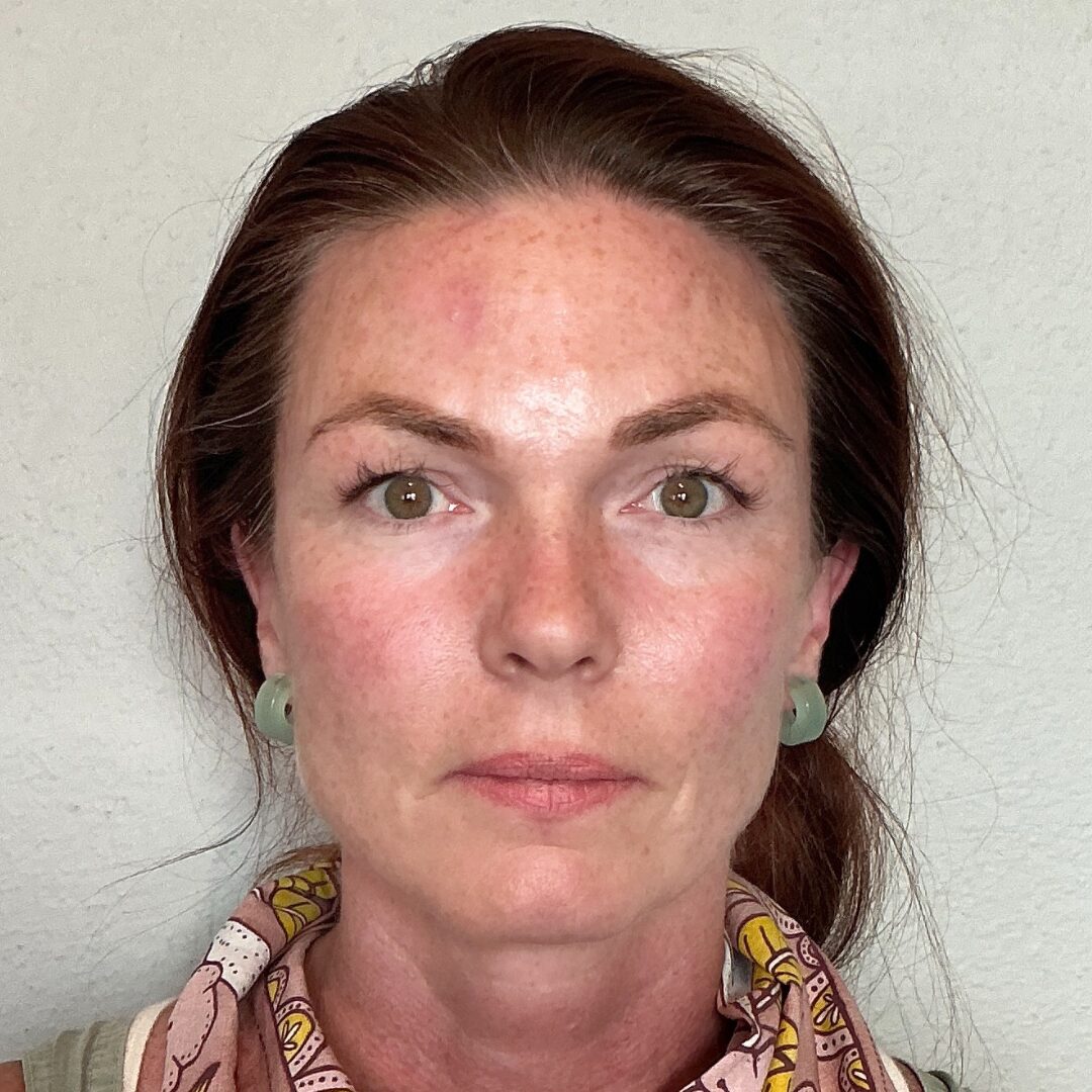 After Image: Filler - front