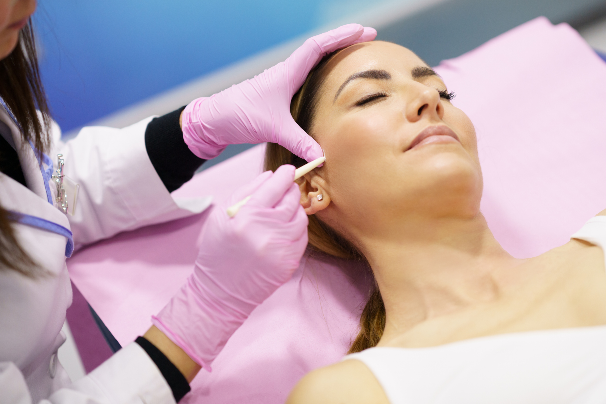 PDO thread lift procedure at Eclipse Medical Aesthetics By Cassandra Rommel, ARNP.
